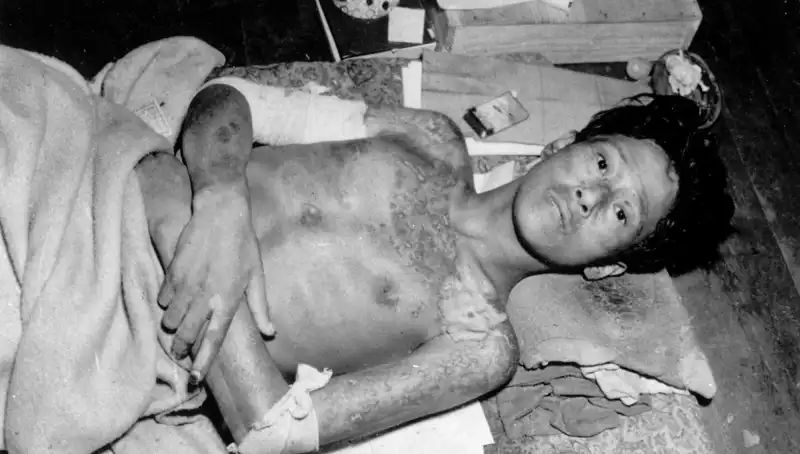 80 Yıldan Sonra Nagasaki'den Nükleer Alarm: Felaket Yakın mı?