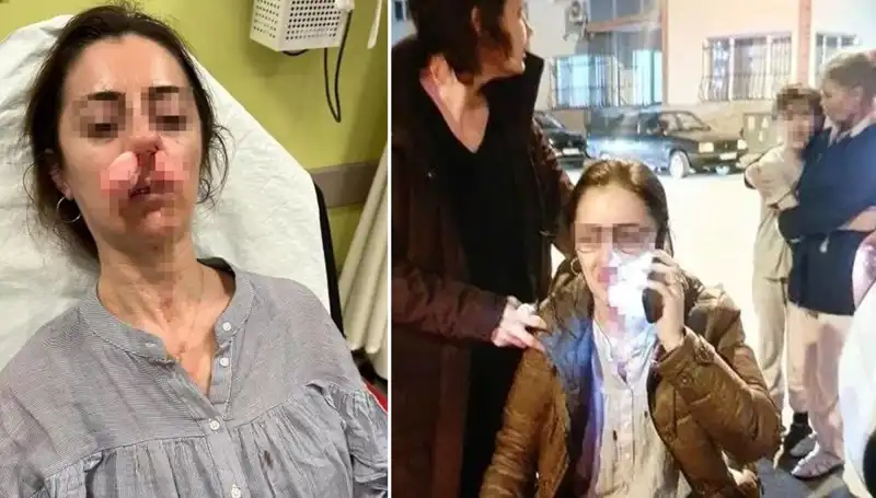 Otomobil Kapısı Silah Sayıldı: Eşinin Sevgilisiyle Yaşanan Sıra Dışı Olay