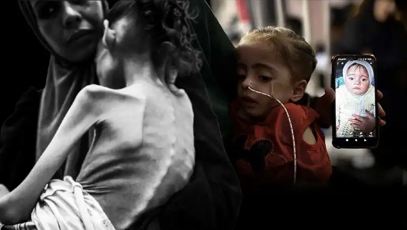 Küçük Meryem'in Zorlu Mücadelesi: 25 Kilodan 10 Kiloya Düşen Bir Hayat