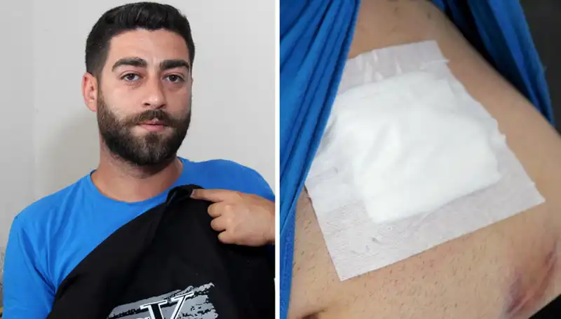 Karnındaki Ağrı, Gizli Bir Tehlikenin Belirtisi Çıktı!